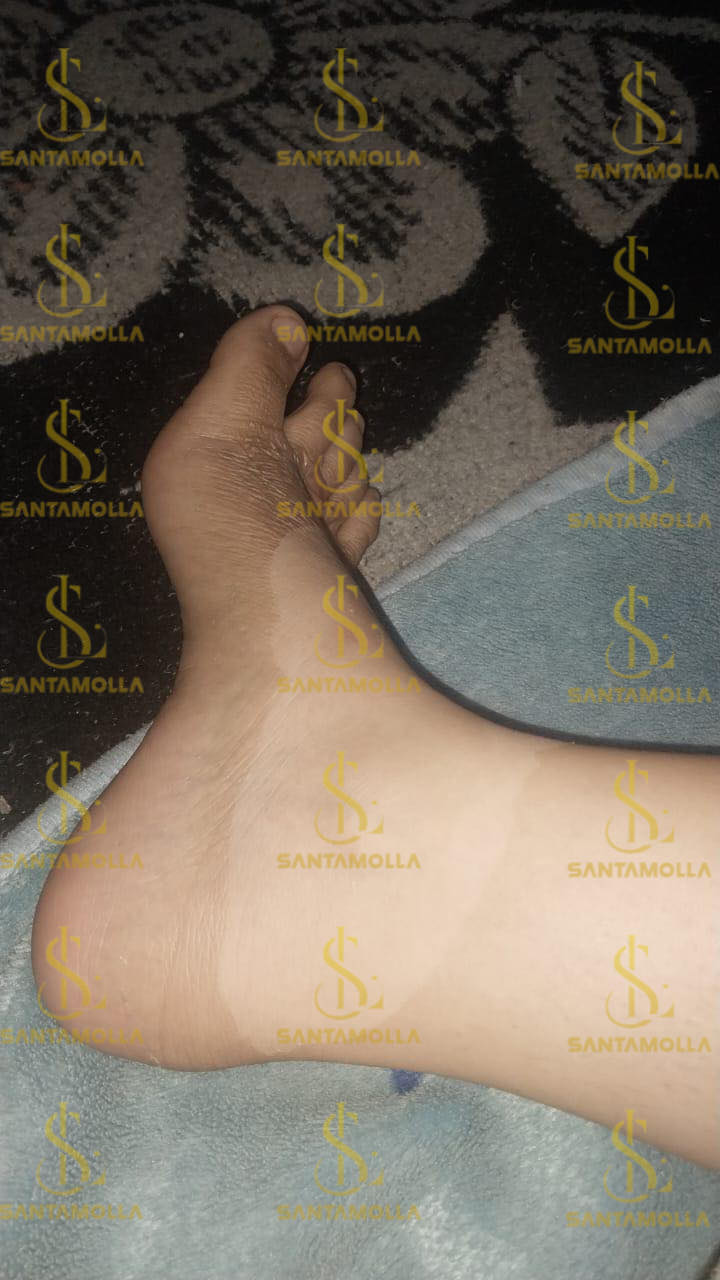 Santamolla peeling %25 مقشر لمناطق (الكوع .الركب .كف اليد . وش الرجل )