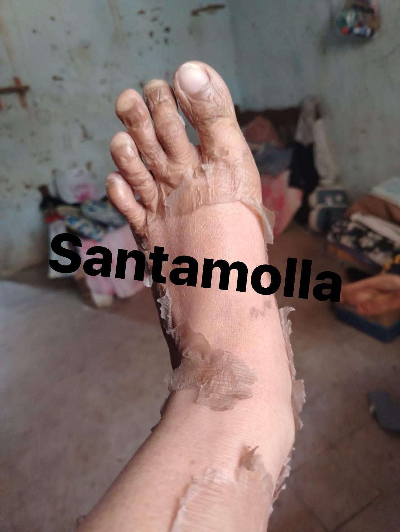 Santamolla peeling %25  مقشر لمناطق (الكوع .الركب .كف اليد . وش الرجل )