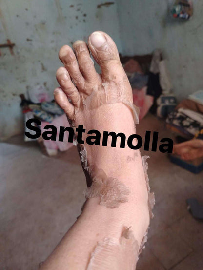 Santamolla peeling %25  مقشر لمناطق (الكوع .الركب .كف اليد . وش الرجل )