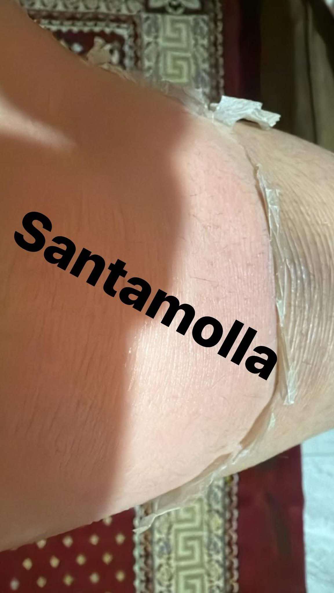 Santamolla peeling %25  مقشر لمناطق (الكوع .الركب .كف اليد . وش الرجل )