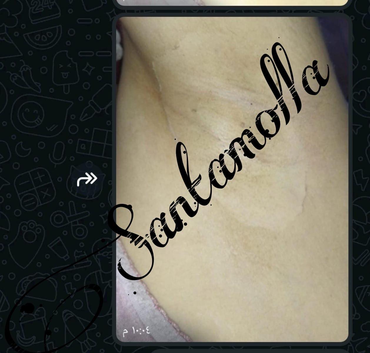 Santamolla peeling %15