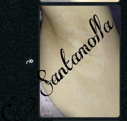 Santamolla peeling %15