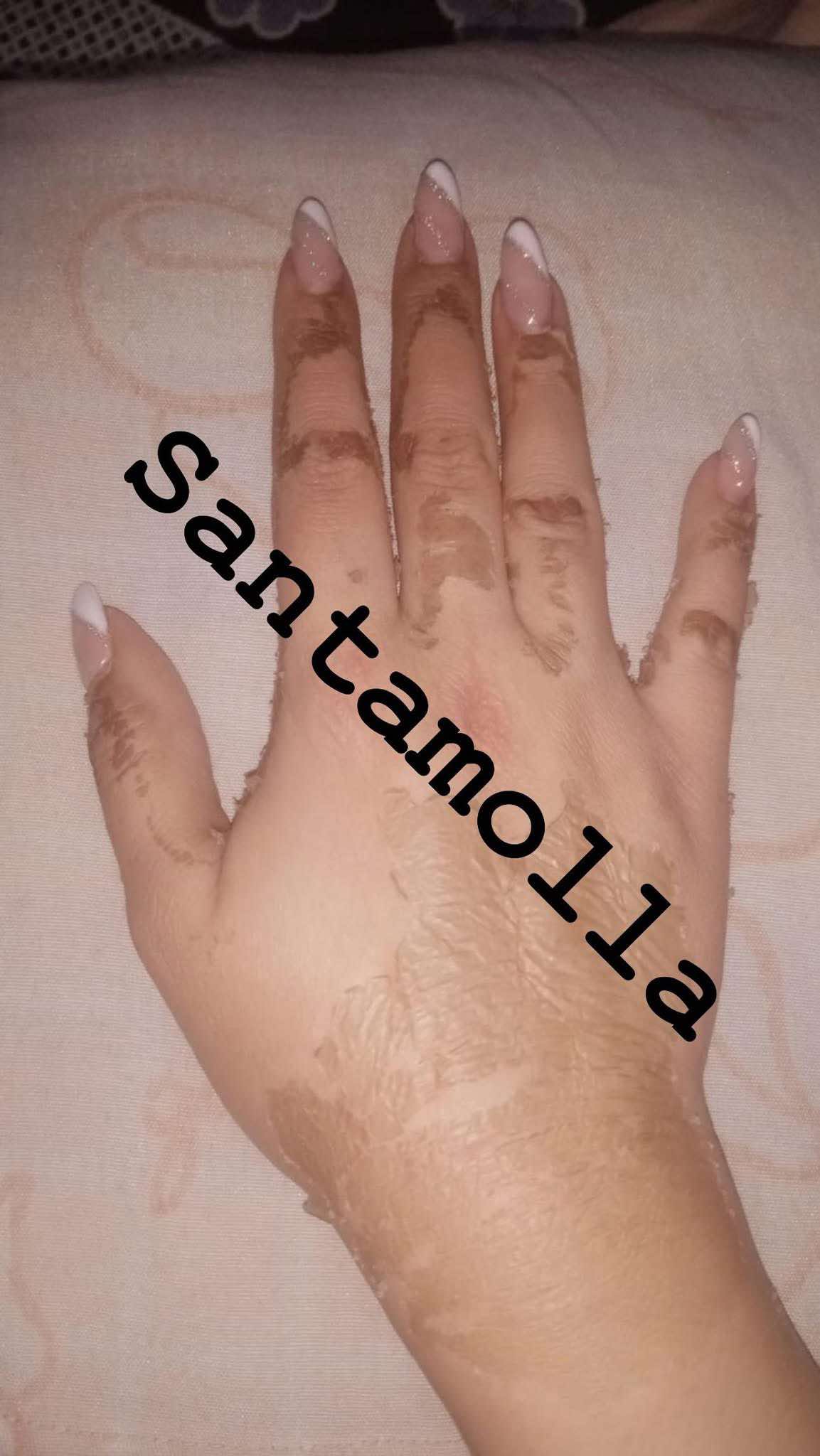 Santamolla peeling %25  مقشر لمناطق (الكوع .الركب .كف اليد . وش الرجل )