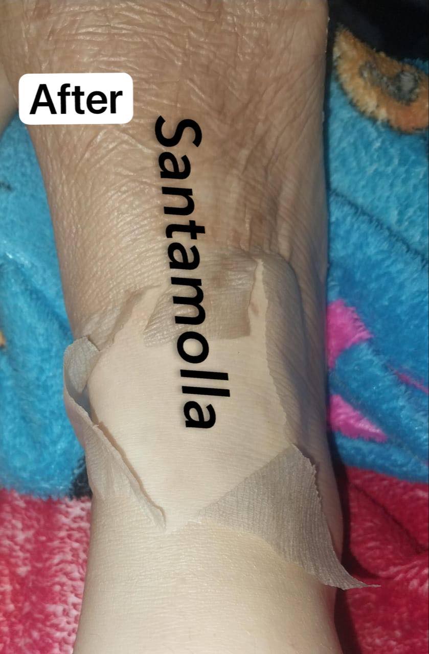Santamolla peeling %25  مقشر لمناطق (الكوع .الركب .كف اليد . وش الرجل )