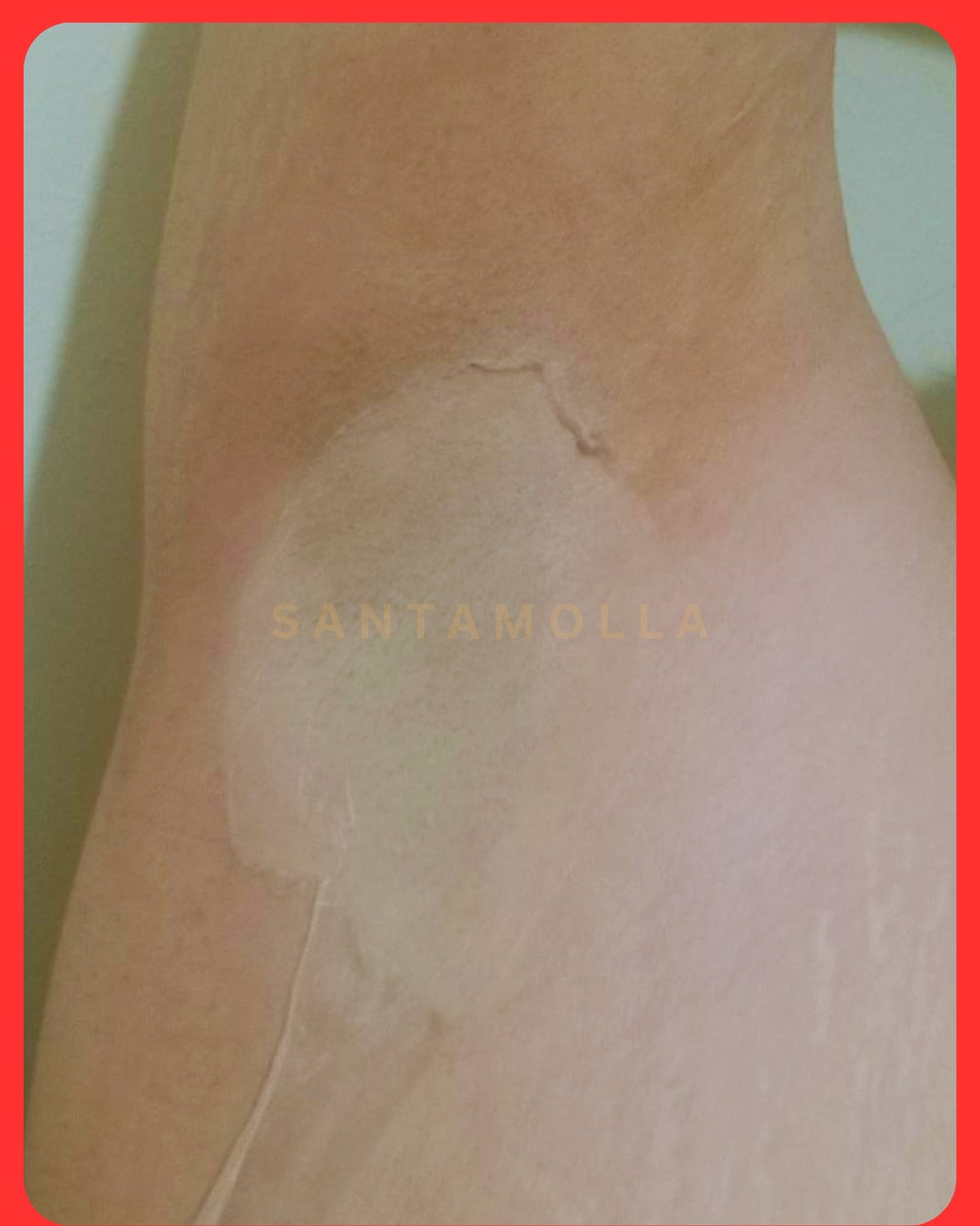 Santamolla peeling %15