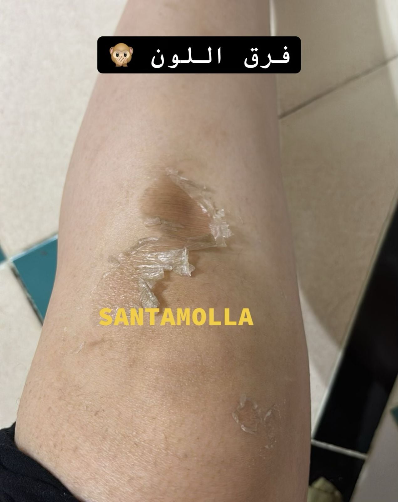 Santamolla peeling %25  مقشر لمناطق (الكوع .الركب .كف اليد . وش الرجل )
