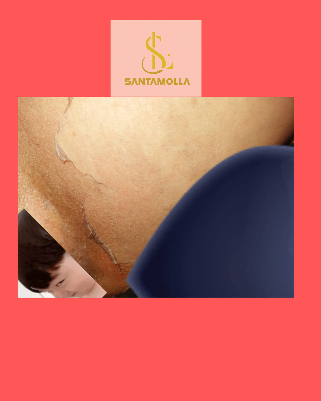 Santamolla peeling %15